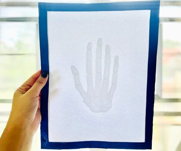 Light Box X-ray